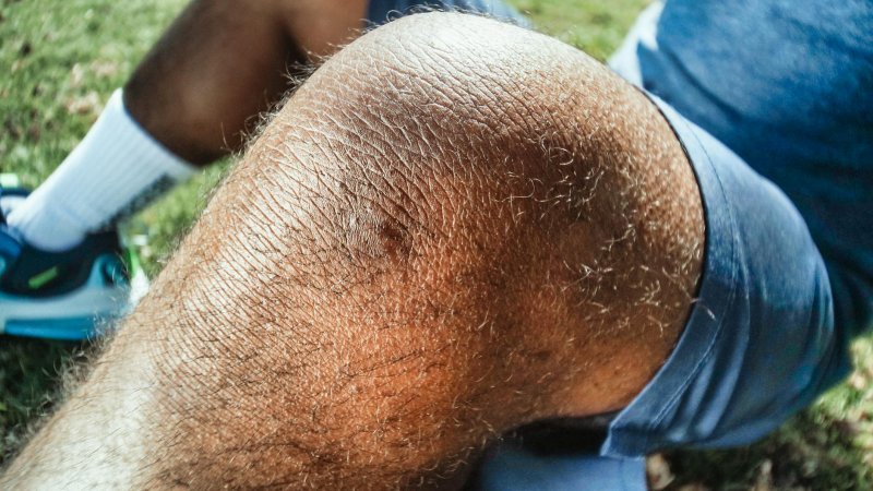 How HBOT Transforms Crush Injuries and Compartment Syndrome
